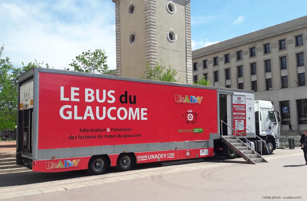 bus du glaucome