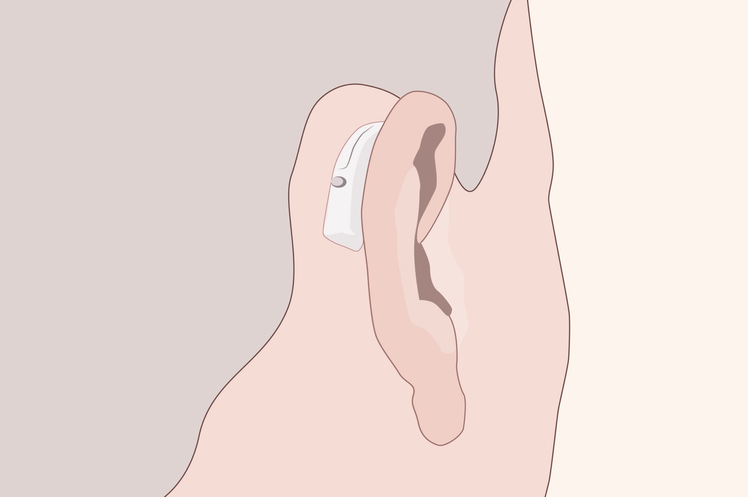 Illustration de micro-contour d'oreille