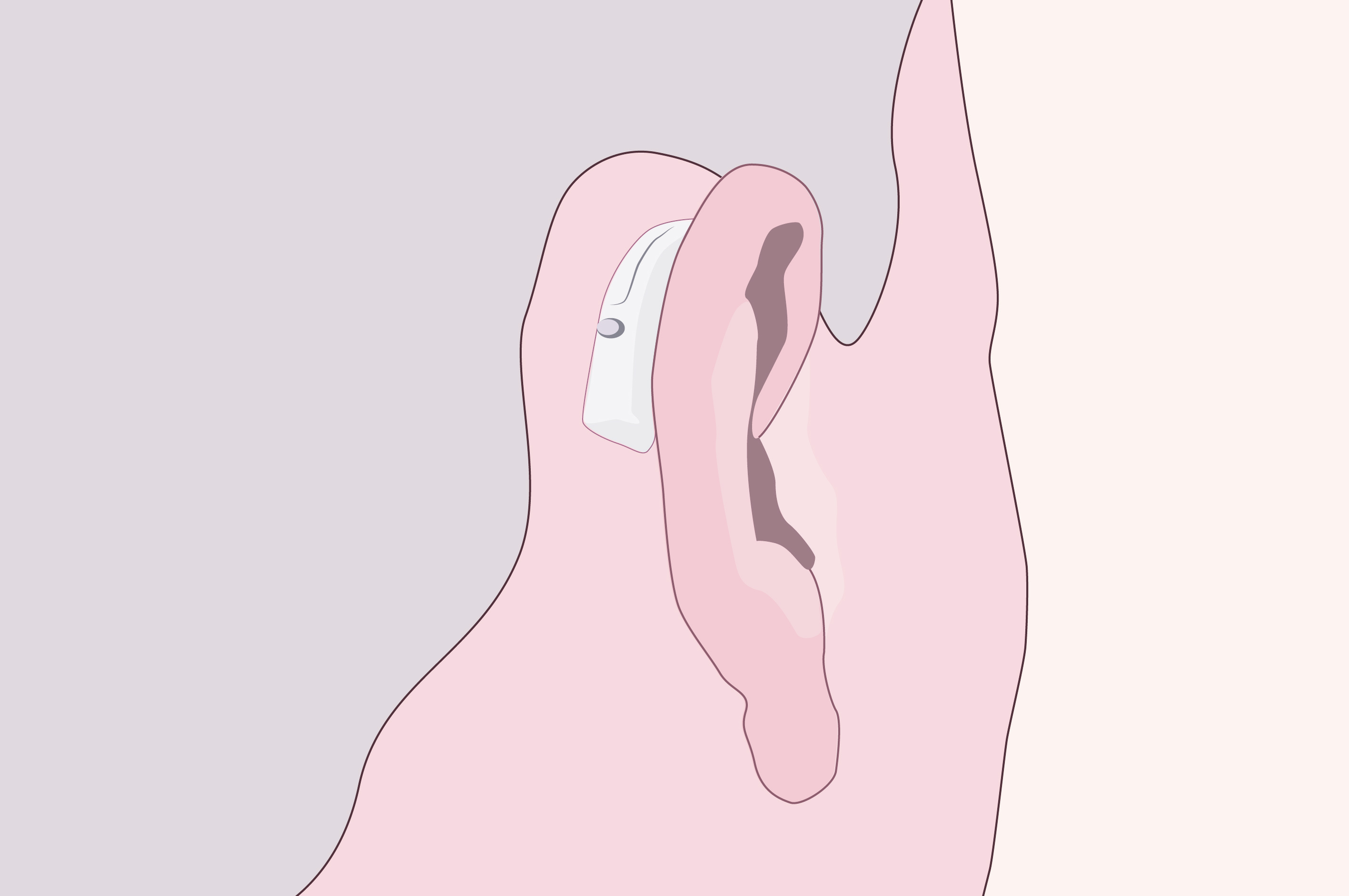 Illustration de micro-contour d'oreille